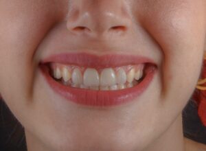 best foods for healthy teeth